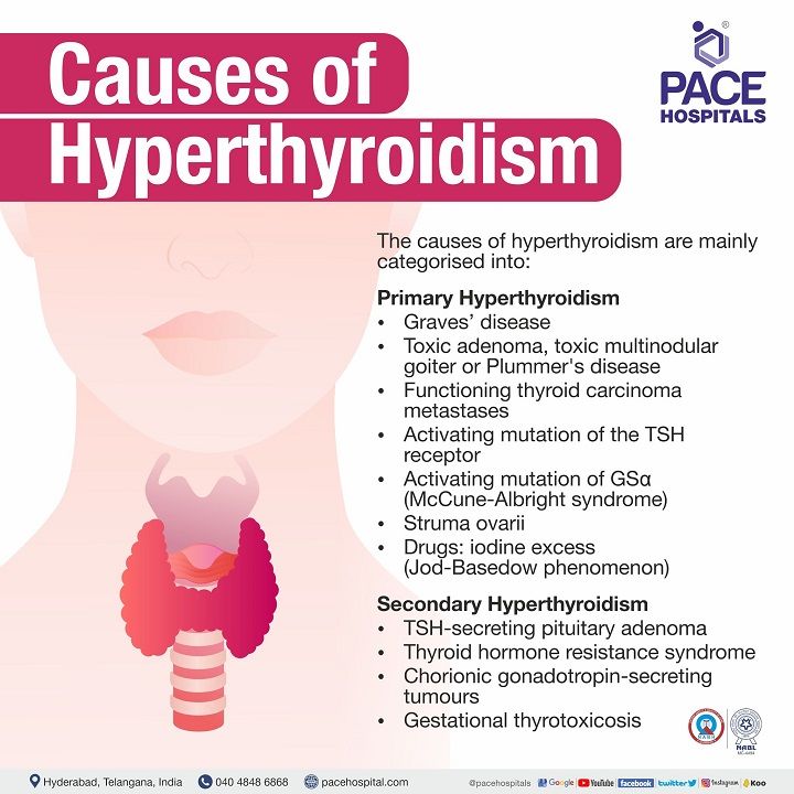 Overactive Thyroid Hyperthyroidism Disease Symptoms And Causes